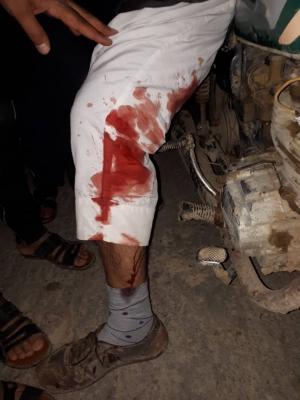 قوات الامن و الحرس الثوري الايرانية تهاجم المواطنين الأحوازيين في قريتي الجليزي و مليحان و جرح العشرات